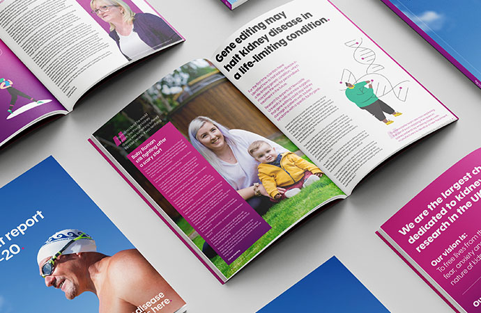 Kidney Research UK